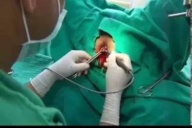best hospital for piles surgery in Purnia, best doctor for piles fissure treatment in Purnia, cost of piles fissure surgery in Purnia
